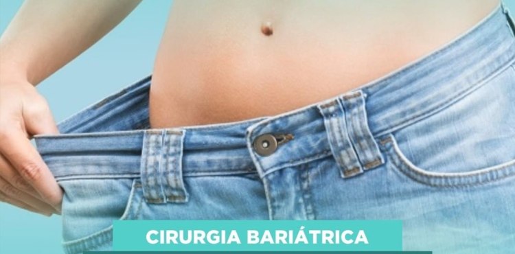 Mitos e Verdade: Bariátrica