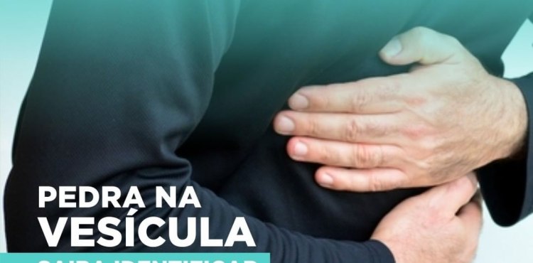 Saiba Identificar Pedra na Vesí­cula