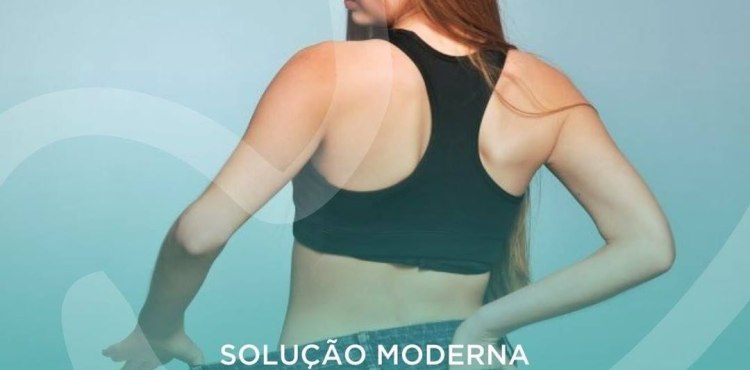 SoluÃ§Ã£o Moderna para Obesidade
