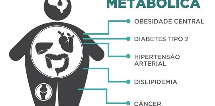 SÃ­ndrome MetabÃ³lica