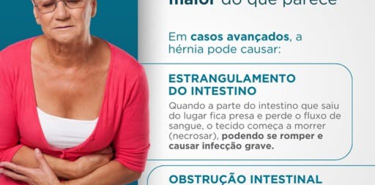 Hérnias abdominais: quando o risco é maior do que parece