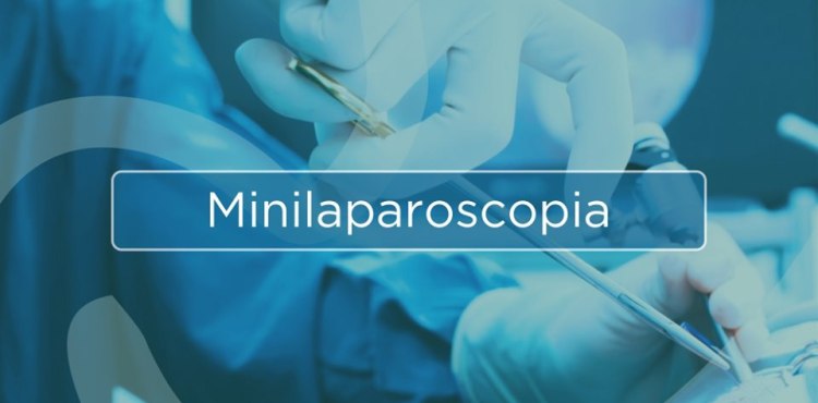 Minilaparoscopia - Saiba Mais