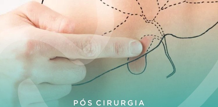 PÃ³s Cirurgia | Pedra na VesÃ­cula