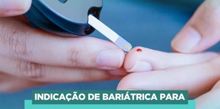 CFM amplia indicação de bariátrica para pacientes com diabetes⠀