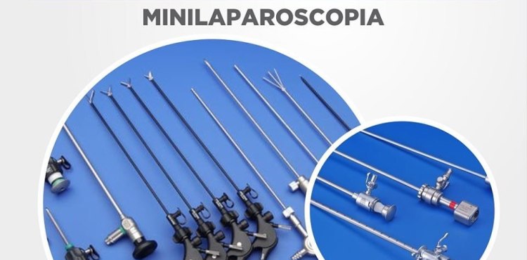 Tratamento CÃ¡lculo de VesÃ­cula Biliar - Minilaparoscopia
