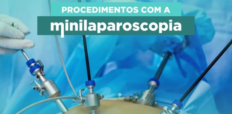 Procedimentos com a  Minilaparoscopia