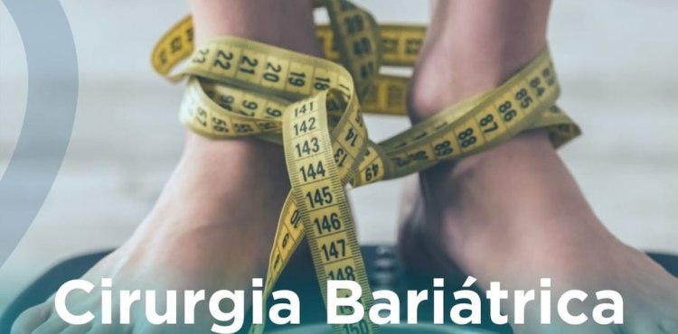Cirurgia BariÃ¡trica - Bypass GÃ¡strico