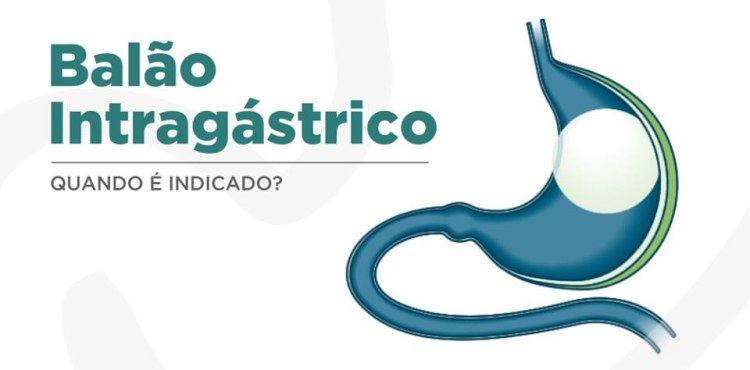 IndicaÃ§Ãµes - BalÃ£o IntragÃ¡trico